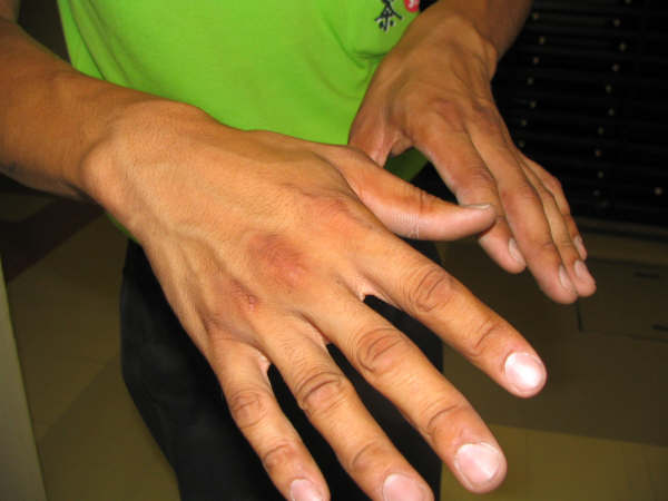 働き者の奇麗な手
